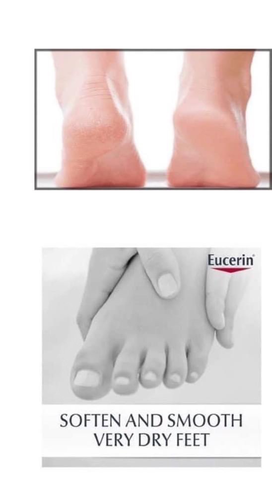 Kem bôi ngừa nứt gót chân Eucerin 100 ML - Bill Pháp