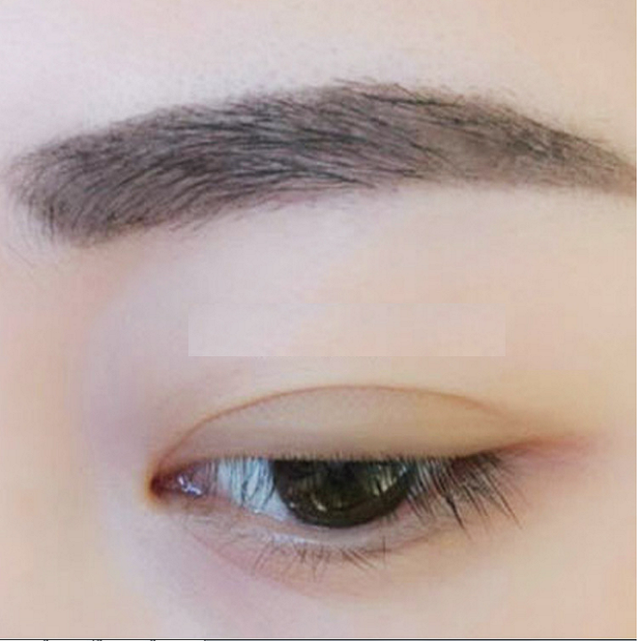 6 vỉ kích mí lưới 96 miếng cho mắt 1 mí sụp mí