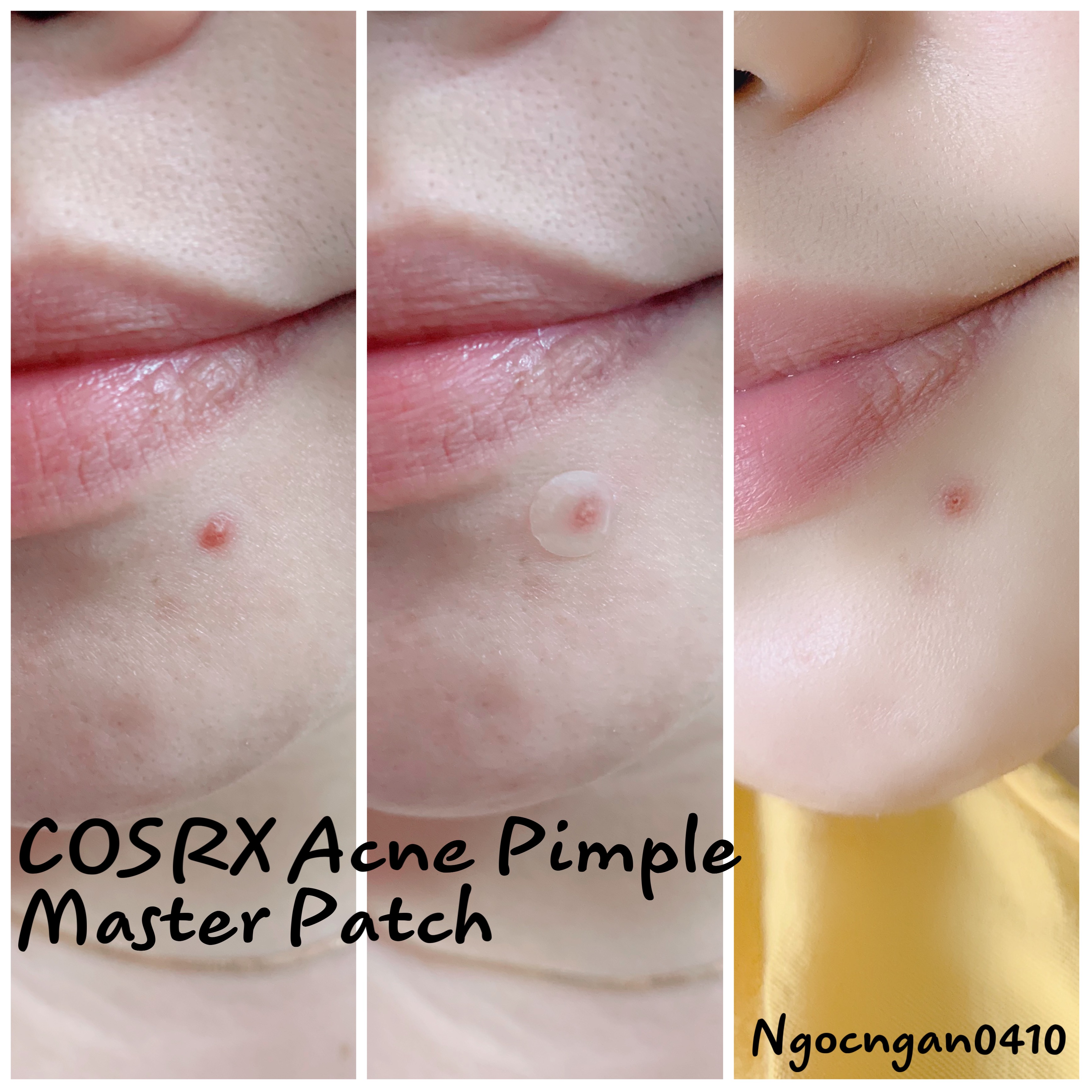 Miếng dán mụn COSRX Acne Pimple Master Patch 24 miếng/ gói