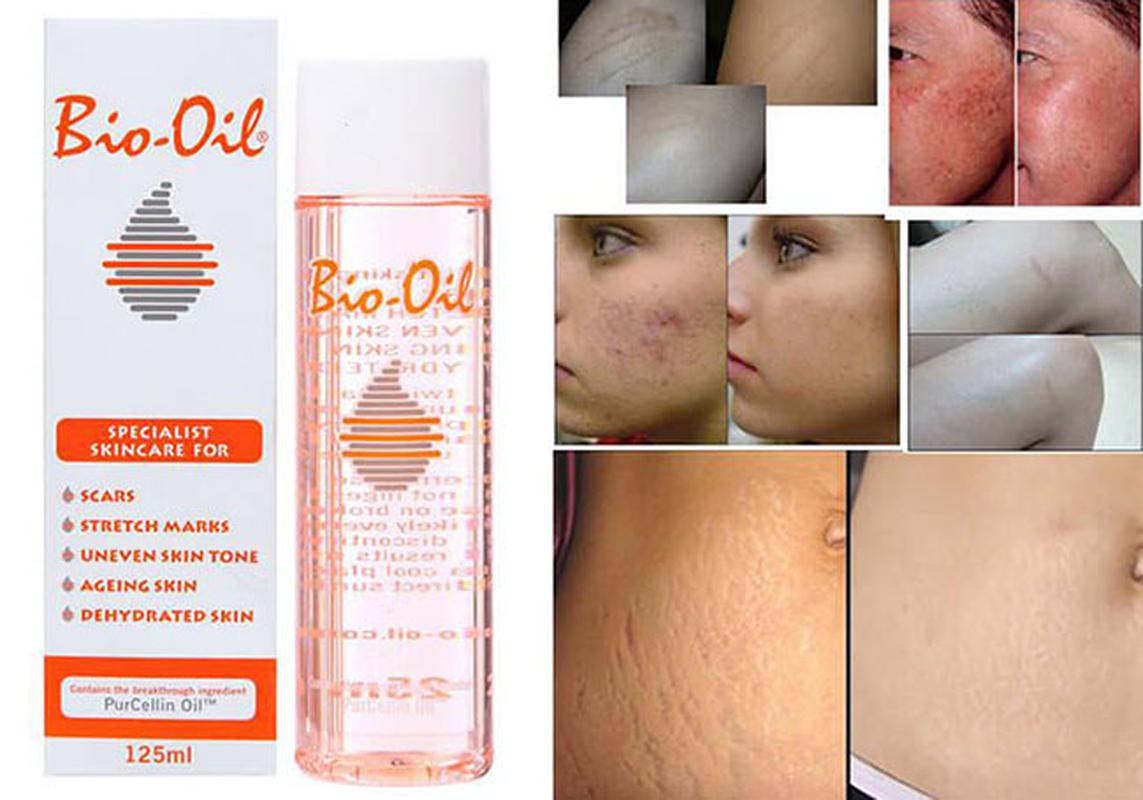 [CHÍNH HÃNG] Tinh Dầu Bio-Oil Mờ Sẹo Giảm Rạn Da