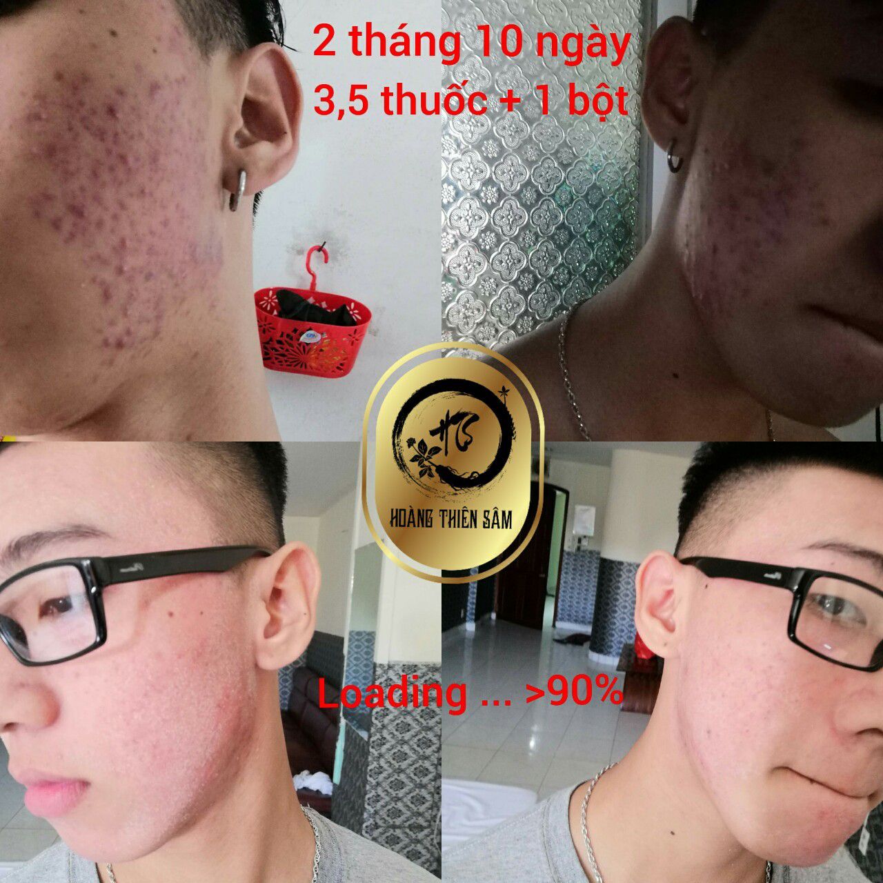 COMBO Tái Tạo Hoàng Thiên Sâm