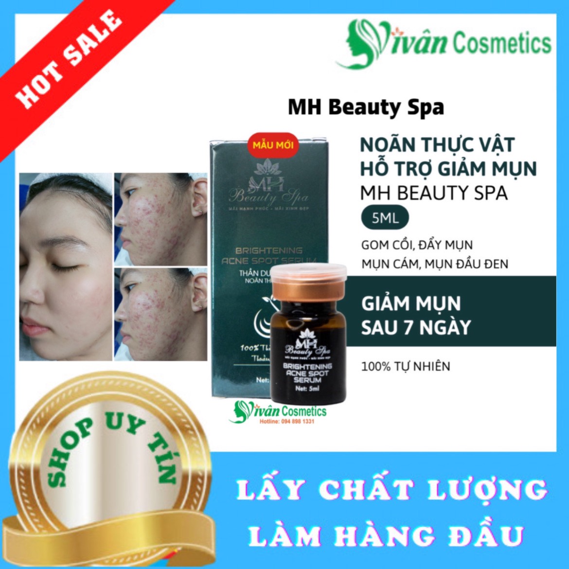 #Noãn thực Vật