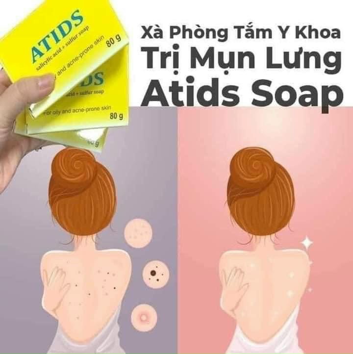Xà phòng tắm Atids