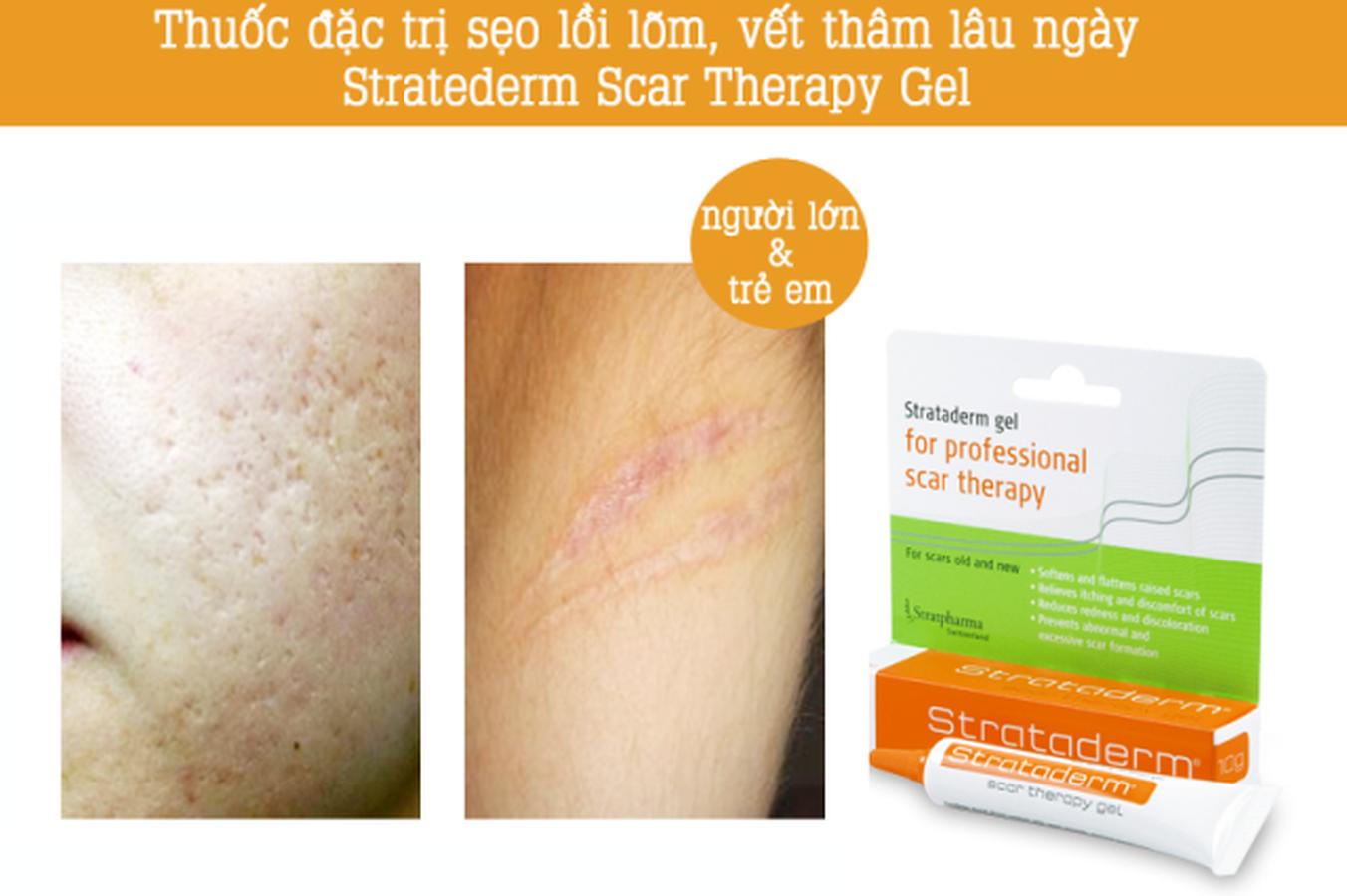 ĐIỀU TRỊ SẸO XẤU. STRATADERM GEL 10G
