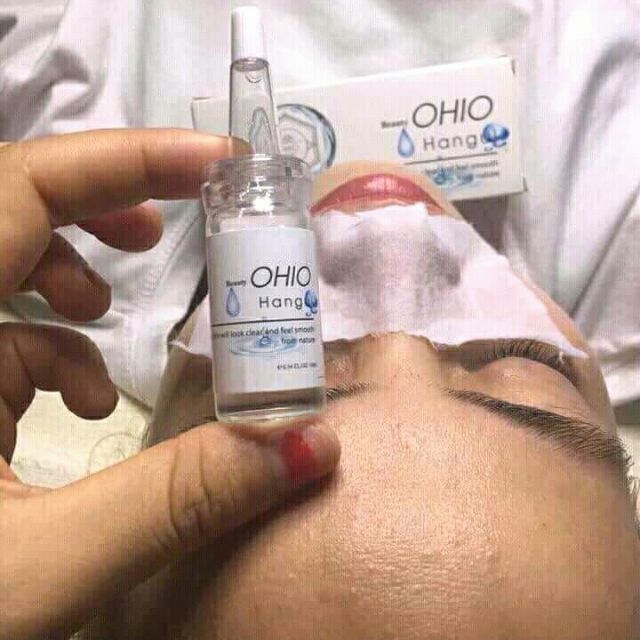 Ủ Mụn Ohio Hangul – Đánh Bay Mụn Đầu Đen Mụn Cám (Mẫu chuẩn)