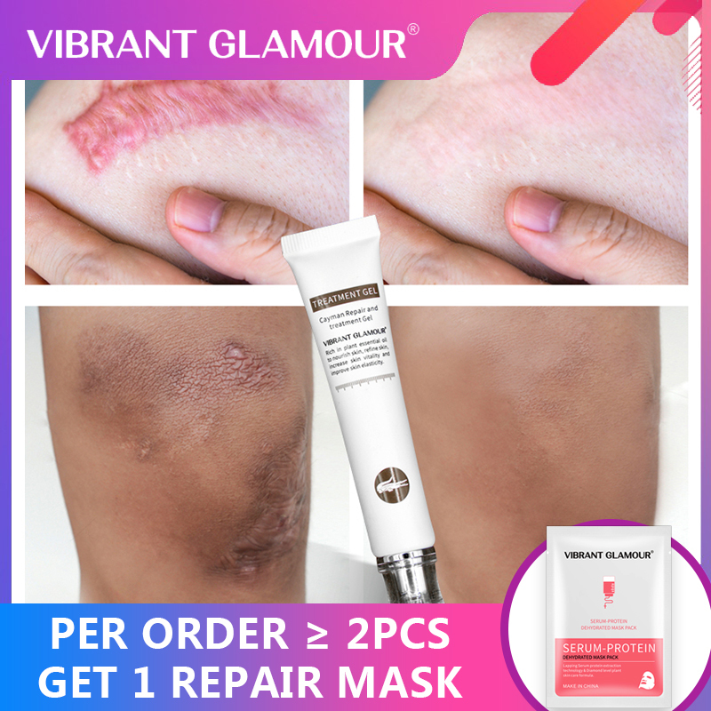 VIBRANT GLAMOUR Serum Dưỡng Phục Hồi, Cải Thiện Vết Thâm, Sẹo Lõm Thu Nhỏ Lỗ Chân Lông Làm Sáng Mịn Da Chăm Sóc Da Nhạy Cảm 30ml giá rẻ