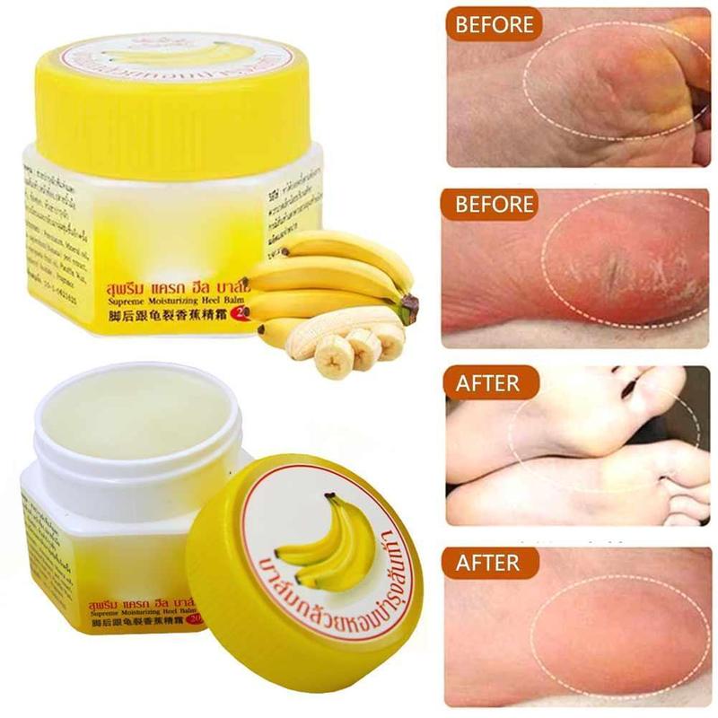 [HCM]KEM CẢI THIỆN NỨT GÓT  CHÂN BANANA