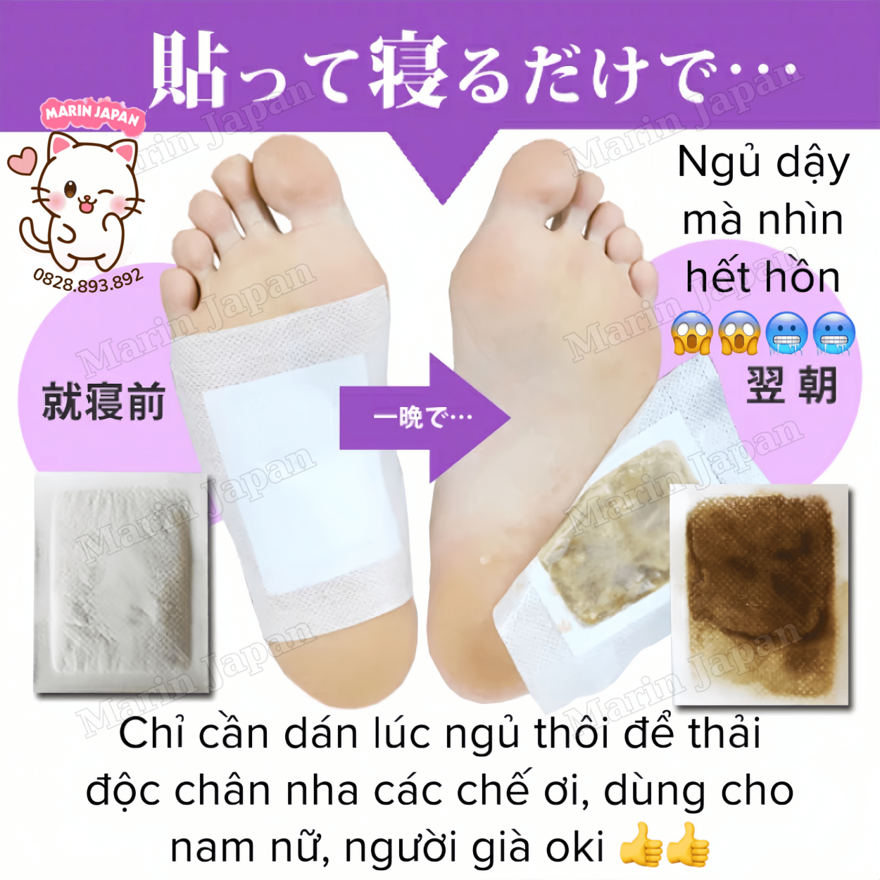 Miếng Dán Thải Độc Chân Kenko Chính Hãng Nhật Bản