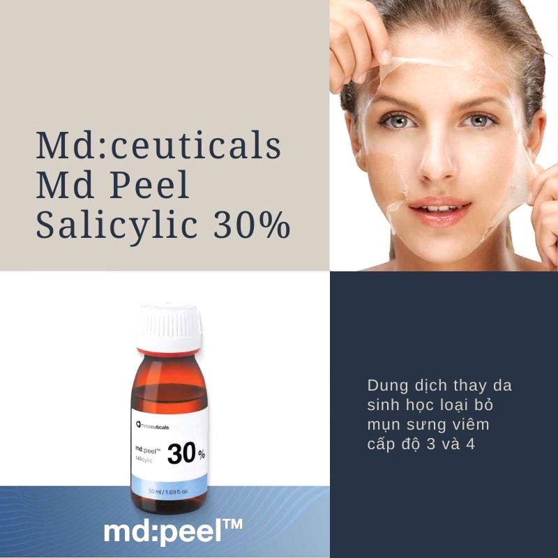 Dung dịch peel md: peel 30% chuyên xử lý mụn