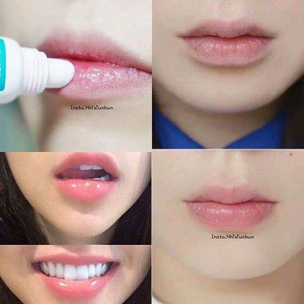 Son Dưỡng Môi Mediheal Labocare Panteno Lips 10ml
