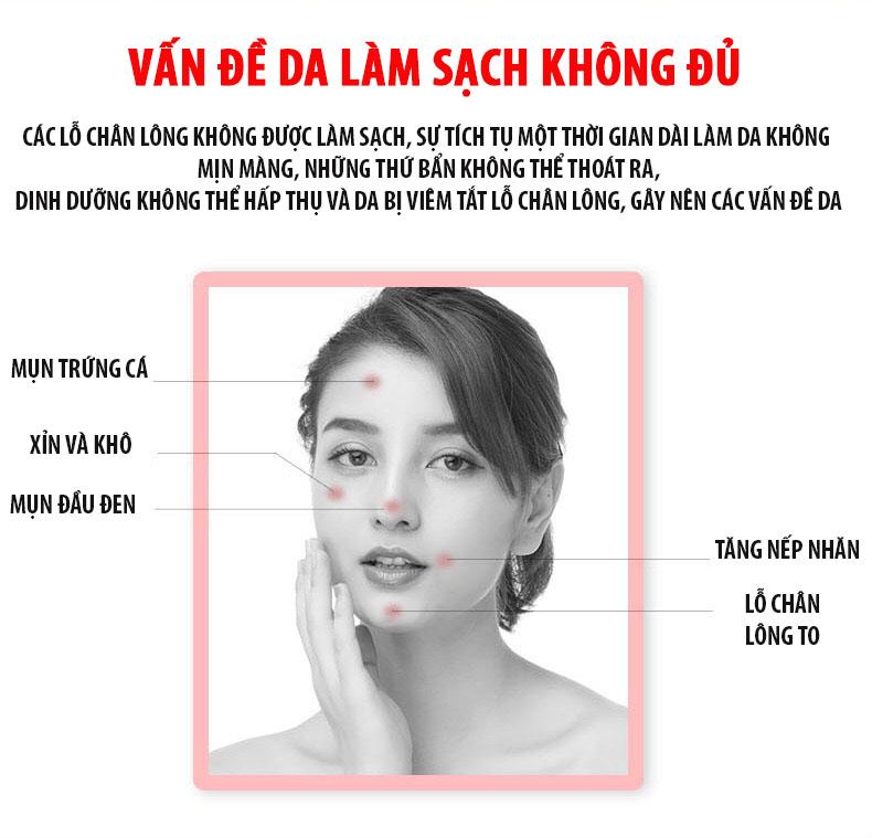 [HCM]Máy Hút Mụn Đầu Đen Bã Nhờn
