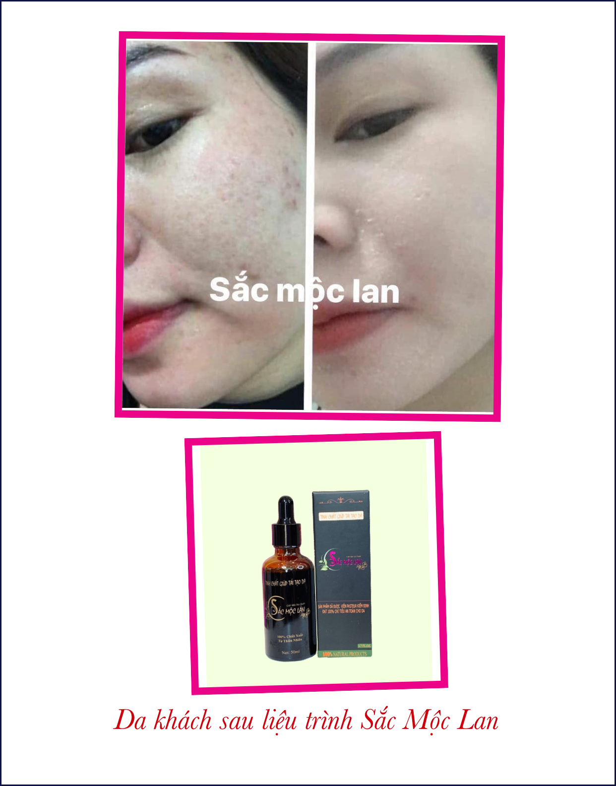 Sắc Mộc Lan - Bộ sản phẩm Sắc Mộc Lan