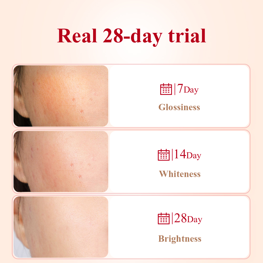 BREYLEE Mặt nạ tinh chất lựu đỏ làm trắng da