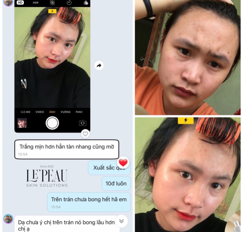 LE’PEAU - Peel da Vi Tảo Retinol [Lepeau tái tạo da sinh học, tặng kèm serum B5 phục hồi da]