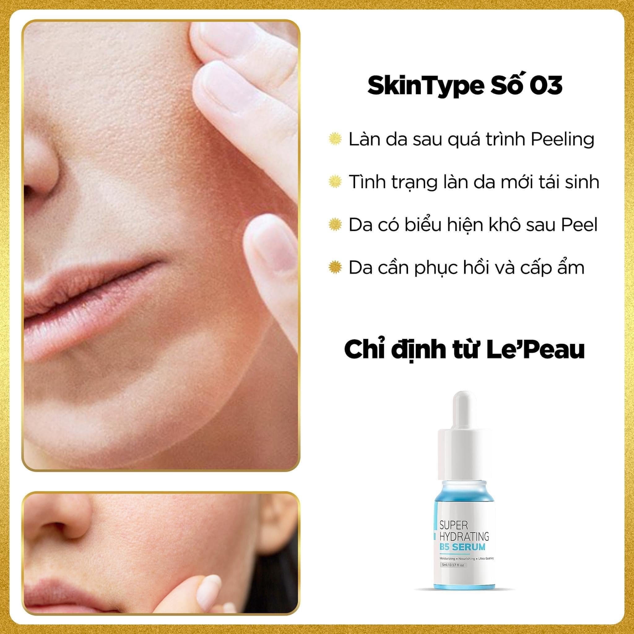 Peel Da vi tảo 7 ngày đẹp (1  bo)