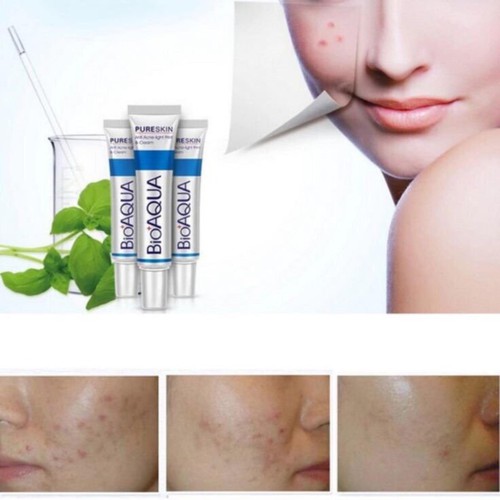 Kem Mụn Trứng Cá Pure Skin Bioaqua