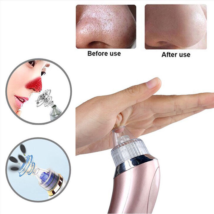 Máy hút mụn đầu đen-Máy hút mụn mini-Máy hút mụn cao cấp