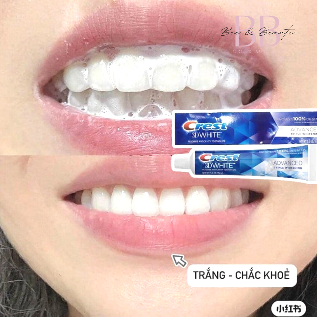 Kem đánh răng Crest 3D White Advance Mỹ, trắng răng, thơm miệng