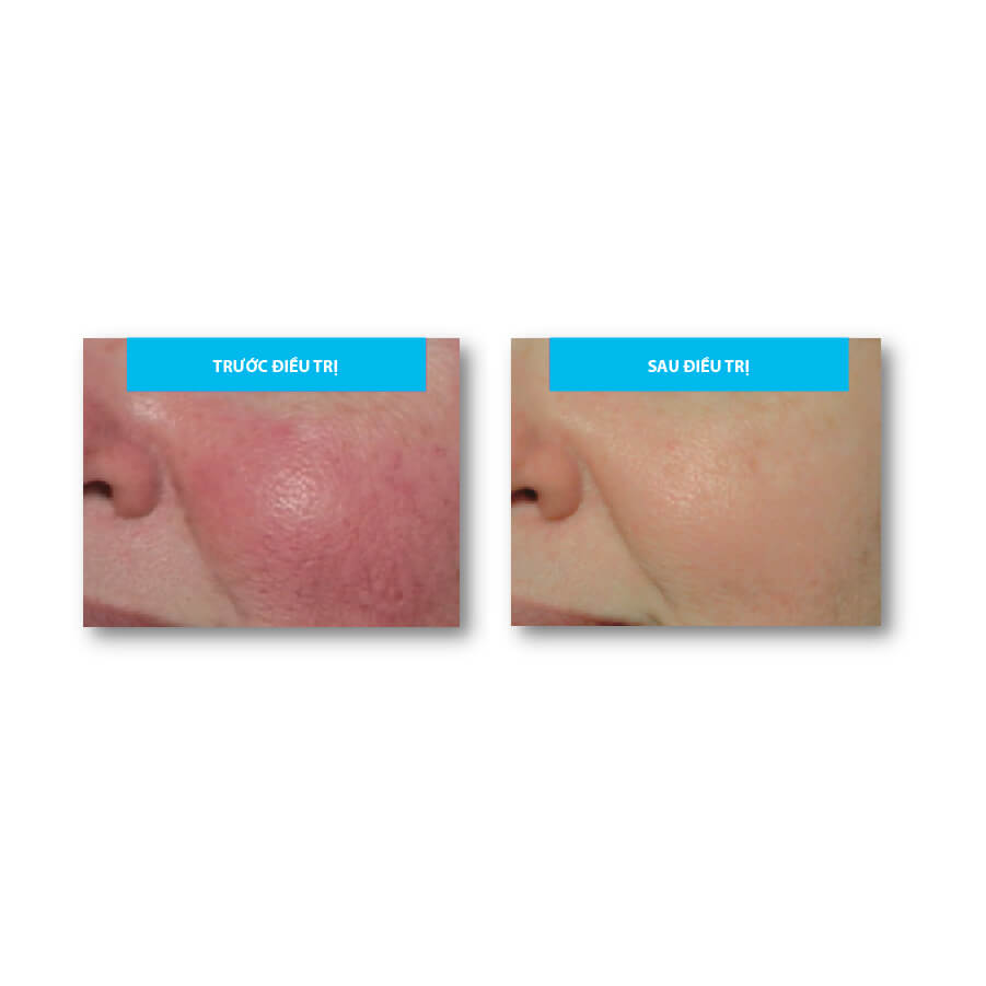 Tinh Chất Trắng Sáng Da MD:Cocktail Tranex White - MD:Ceuticals | Meso cosmetic