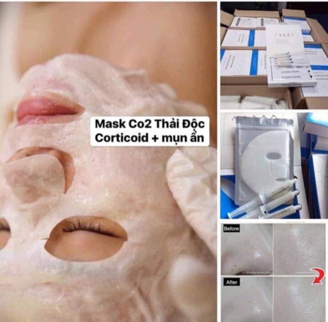 Miếng mặt nạ giấy thải độc CO2 DJ Carbon Therapy(không kèm Tuýp gel)