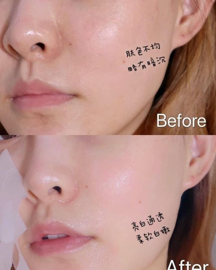 Mặt nạ Banobagi White Jade Treatment Mask