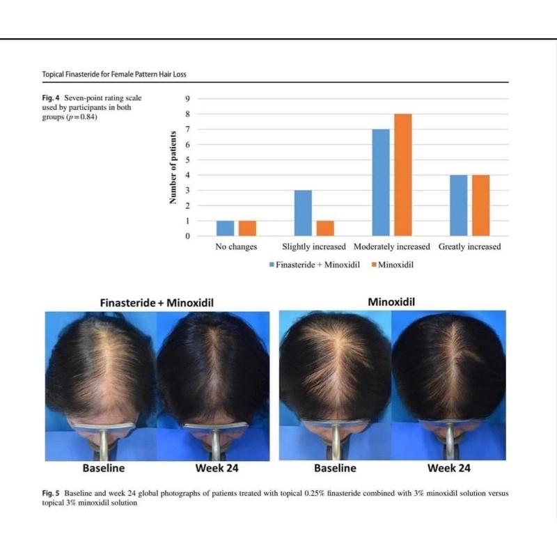 Xịt mọc tóc Minoxidil Bailleul 2% - Xịt ngăn rụng tóc, kích thích mọc tóc  [Hộp 3 lọ 60ml]