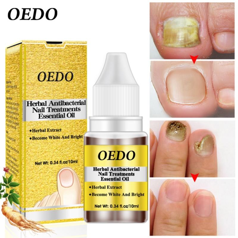 OEDO Herbal Antibacterial Nail Treatments Essential Oil Herbal Extract Nail Fungus Art Repair Tools Foot Nail Care Improve Infection giá rẻ