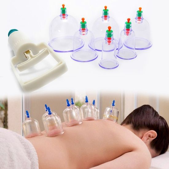 Giác Hơi Cao Cấp 12 Món , Bộ Giác Hơi Không Dùng Lửa, Hút Chân Không, An Toàn Sức Khỏe