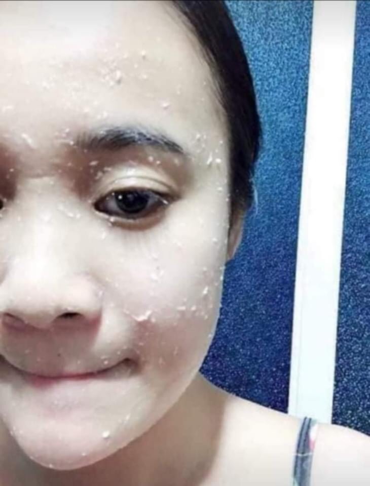 Gel tẩy tế bào chết