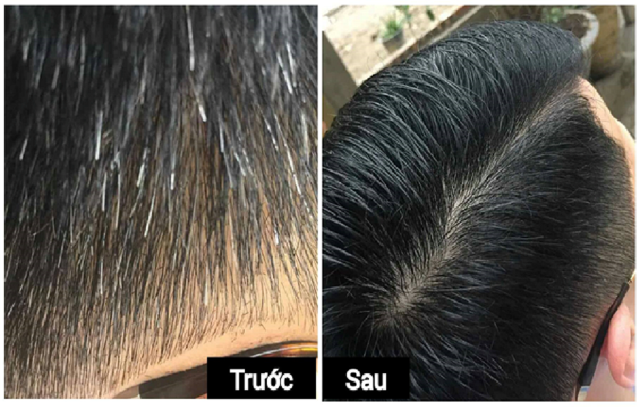 Thuốc nhuộm tóc đen_Gội là đen
