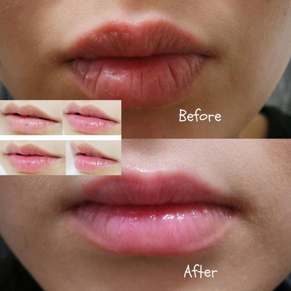 Son Dưỡng Môi Vaseline Lip Therapy Dạng Thỏi 4.8G