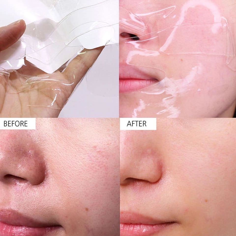 Mặt Nạ Celderma Nintealks Hydrogel Mask