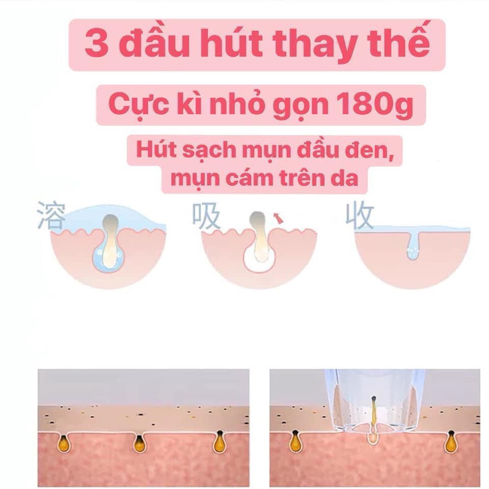 Máy Hút Mụn Đầu Đen Mini Cầm Tay