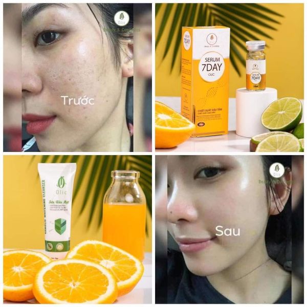 Sữa rửa mặt Olic mẫu mới