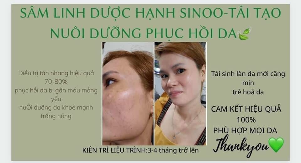 SÂM LINH DƯỢC HẠNH SINOO