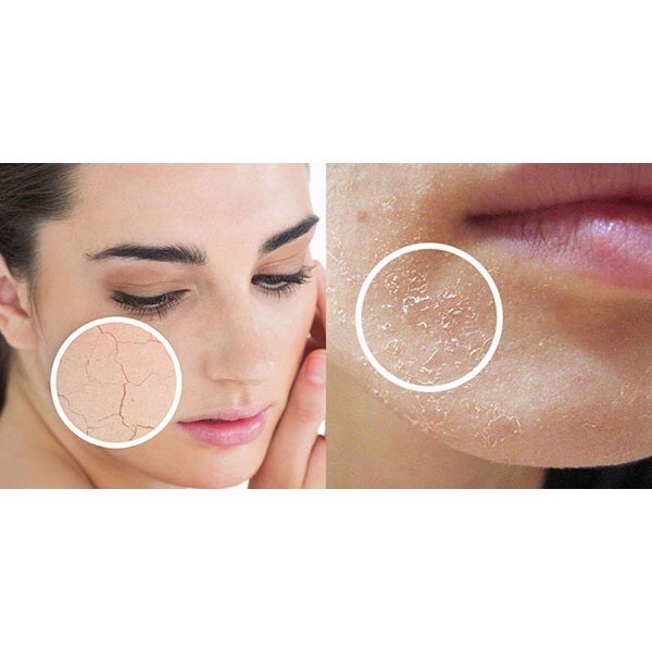 [HCM]VASELINE tuýp  - DỤNG CỤ PHUN XĂM