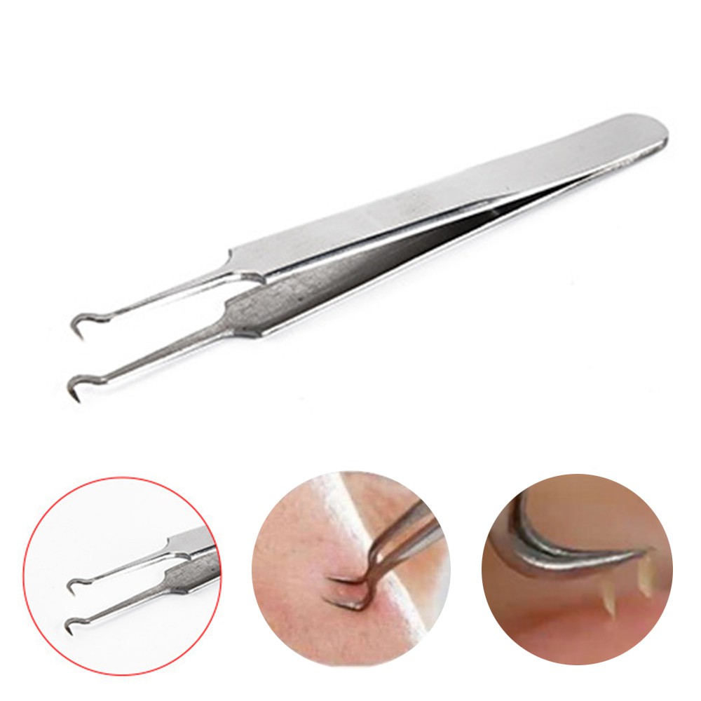 NHÍP GẮP MỤN, que gắp mụn loại dài 12cm