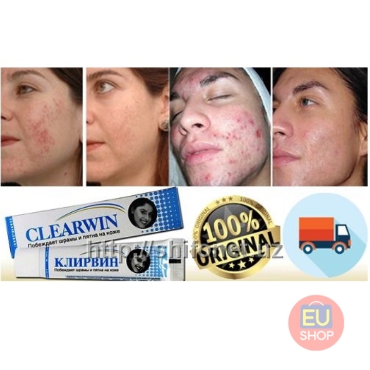 Kem sẹo mụn Clearwin Klirvin ® Nga - Tuýp 25g