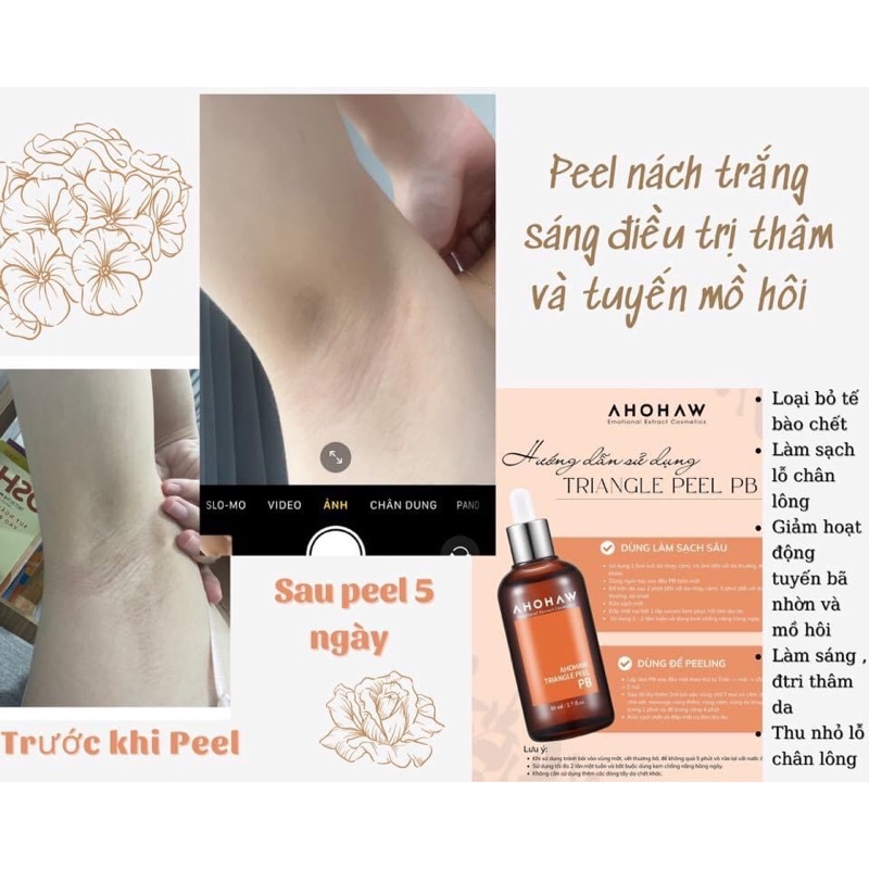 Peel Da Dầu, Mụn Ahohaw Triangle Peel PB