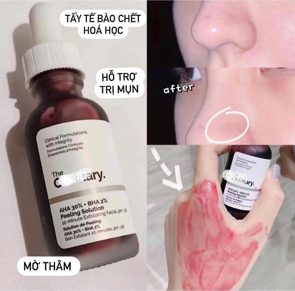 Tinh chất tẩy da chết TO AHA 30% BHA 2% Peeling Solution
