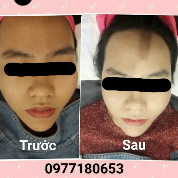 Mặt nạ ủ trắng hoa anh đào Sakura  (MUA 5 TẶNG 1)