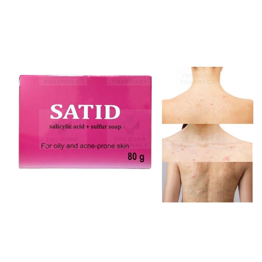Xà bông tắm Satid, giảm mụn lưng, viêm nang lông, giảm tiết bã nhờn, bít tắt lỗ chân lông