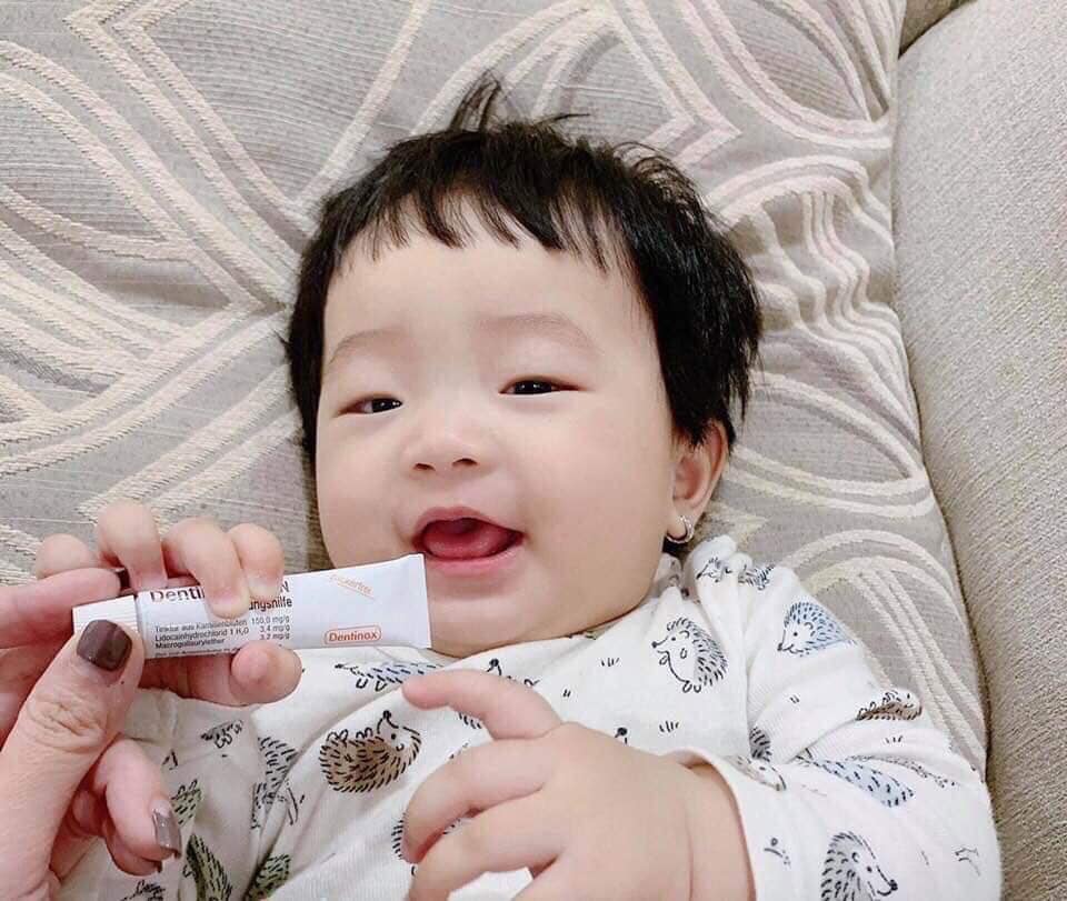 (Review) Gel bôi giảm sưng đau mọc răng Dentinox Đức