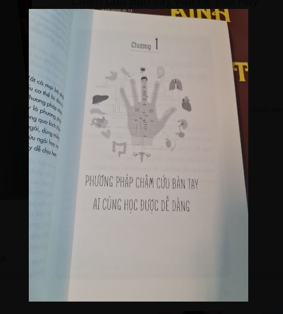 Châm Cứu Bàn Tay Vừa Dễ Vừa Hay