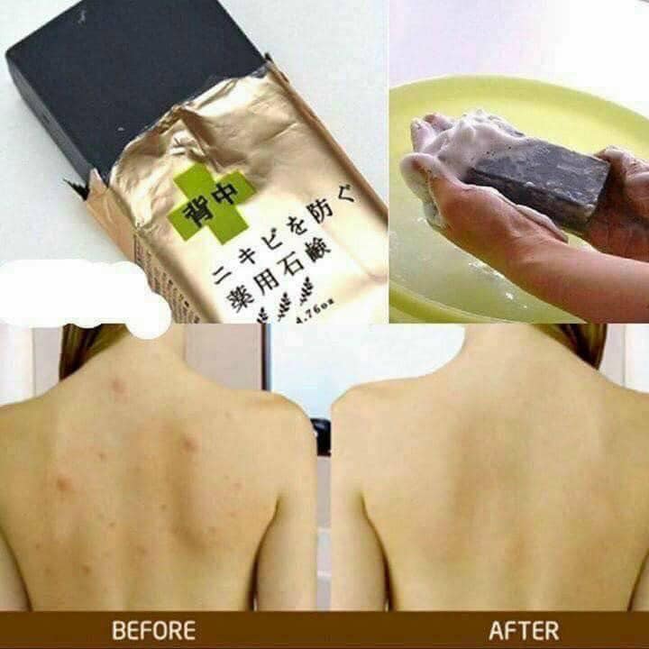 Xà phòng mụn lưng For Back Pelican Nhật