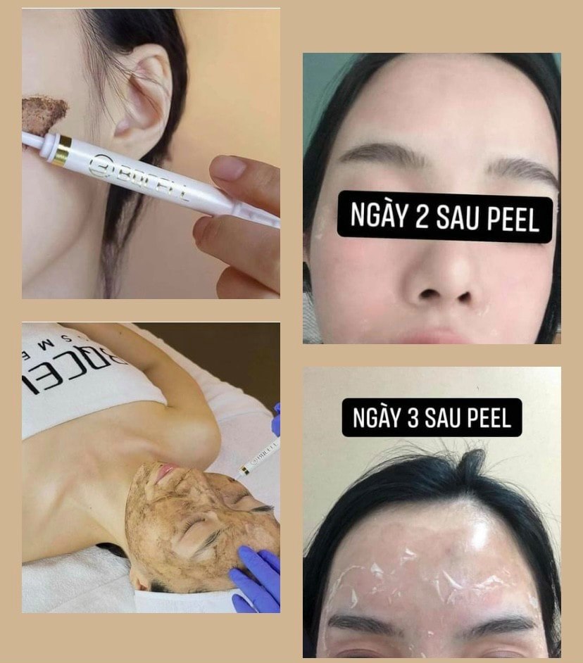 [MẪU 2021] VI TẢO THAY DA SINH HỌC BQ-CELL