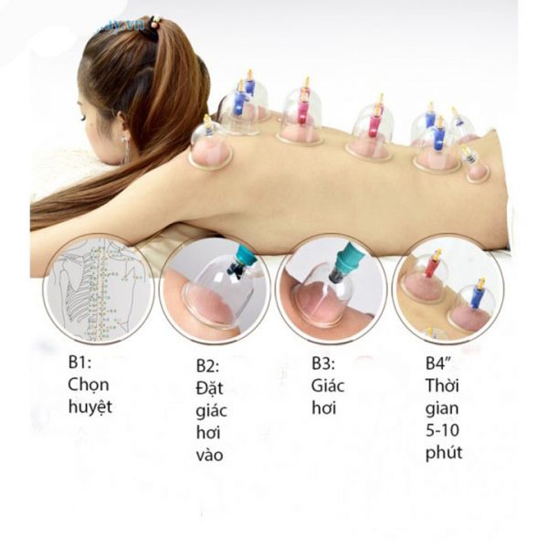 Giác Hơi Cao Cấp 12 Món , Bộ Giác Hơi Không Dùng Lửa, Hút Chân Không, An Toàn Sức Khỏe
