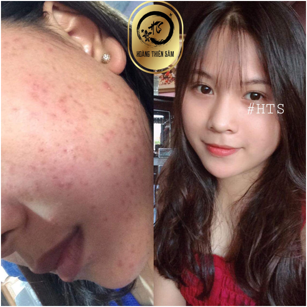 [HCM]Bọt Rửa Mặt Thảo Dược Hoàng Thiên Sâm