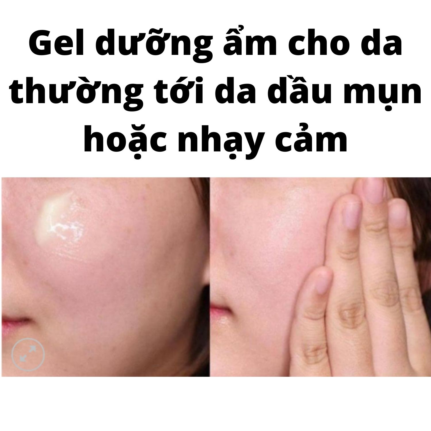 Kem Dưỡng Ẩm 125ml Clinique Dramatically Different Moisturizing Gel Lotion Jelly