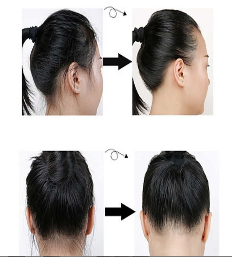[HCM]Chuốc tóc con cố định vào nếp tóc